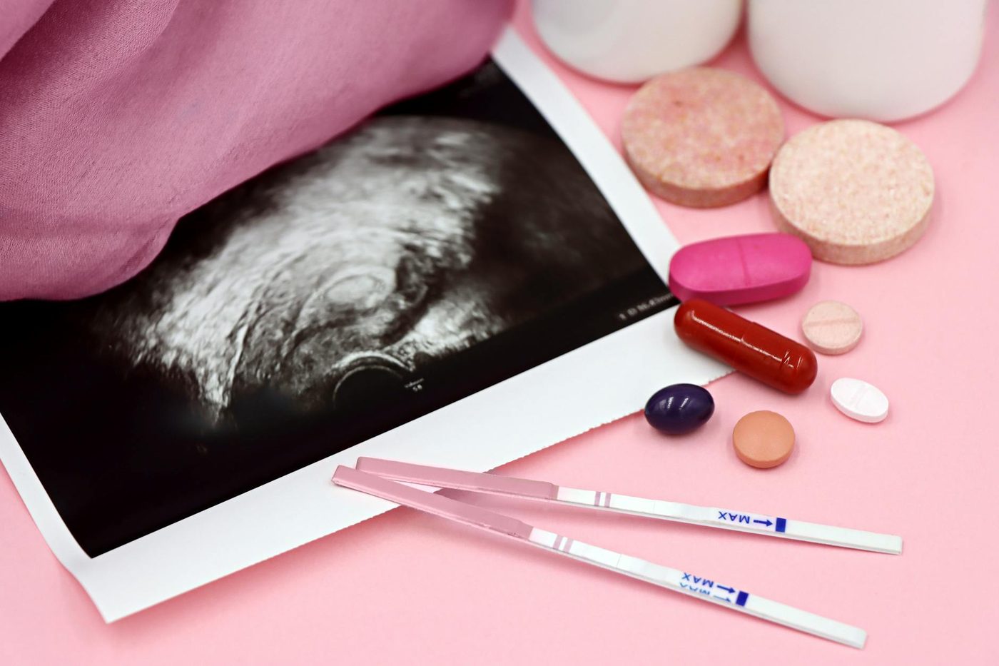 Vroedvrouwen kiezen voor deconventie: Spanningen over eerlijke vergoeding en toegankelijkheid van zorg