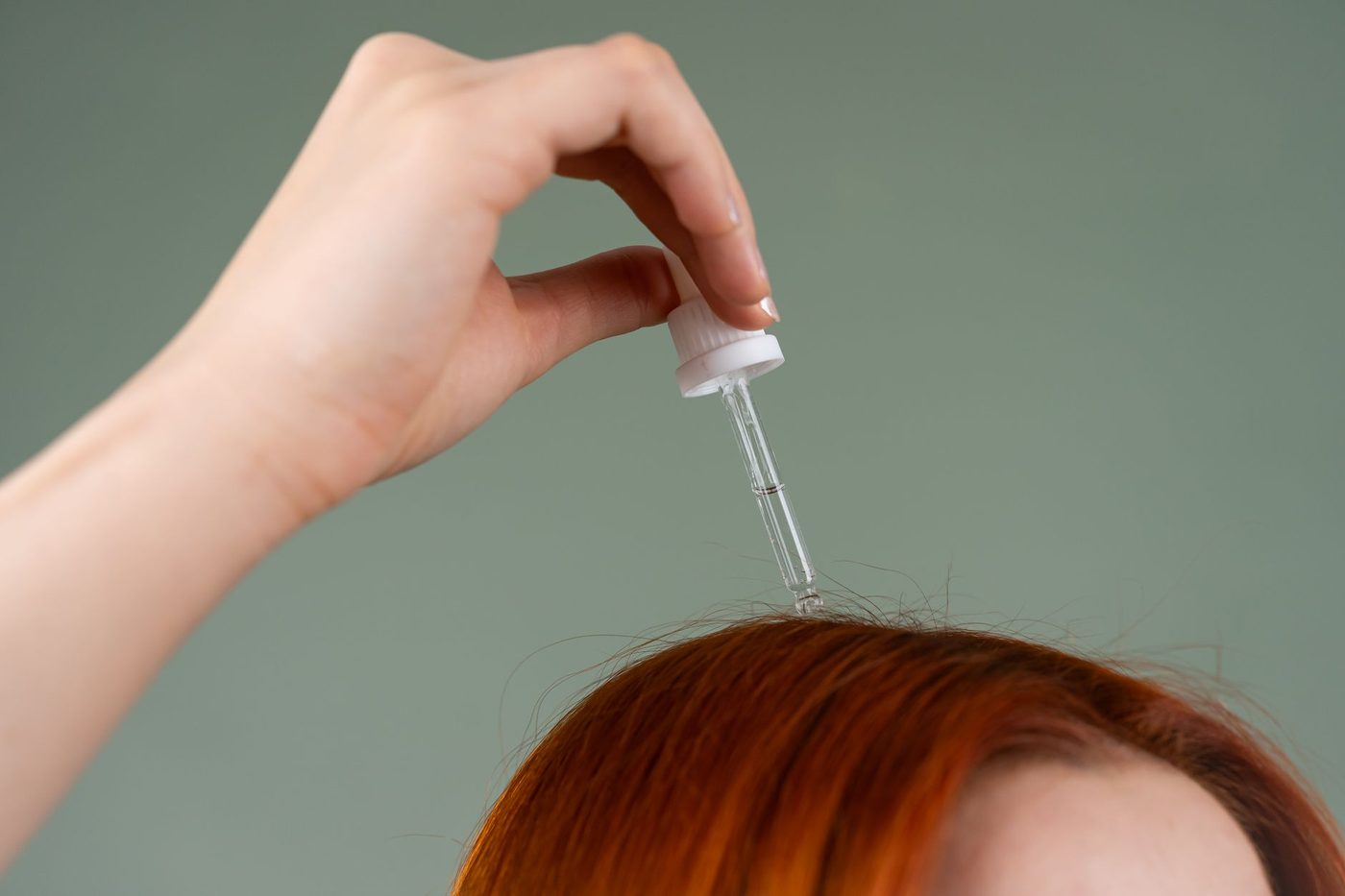Medische doorbraak biedt nieuwe hoop op haargroei voor brandslachtoffer