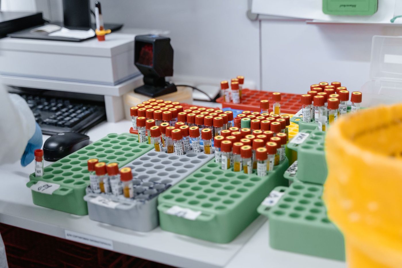 Gepersonaliseerde 'arteries-on-a-chip' kunnen risico op beroertes nauwkeuriger voorspellen