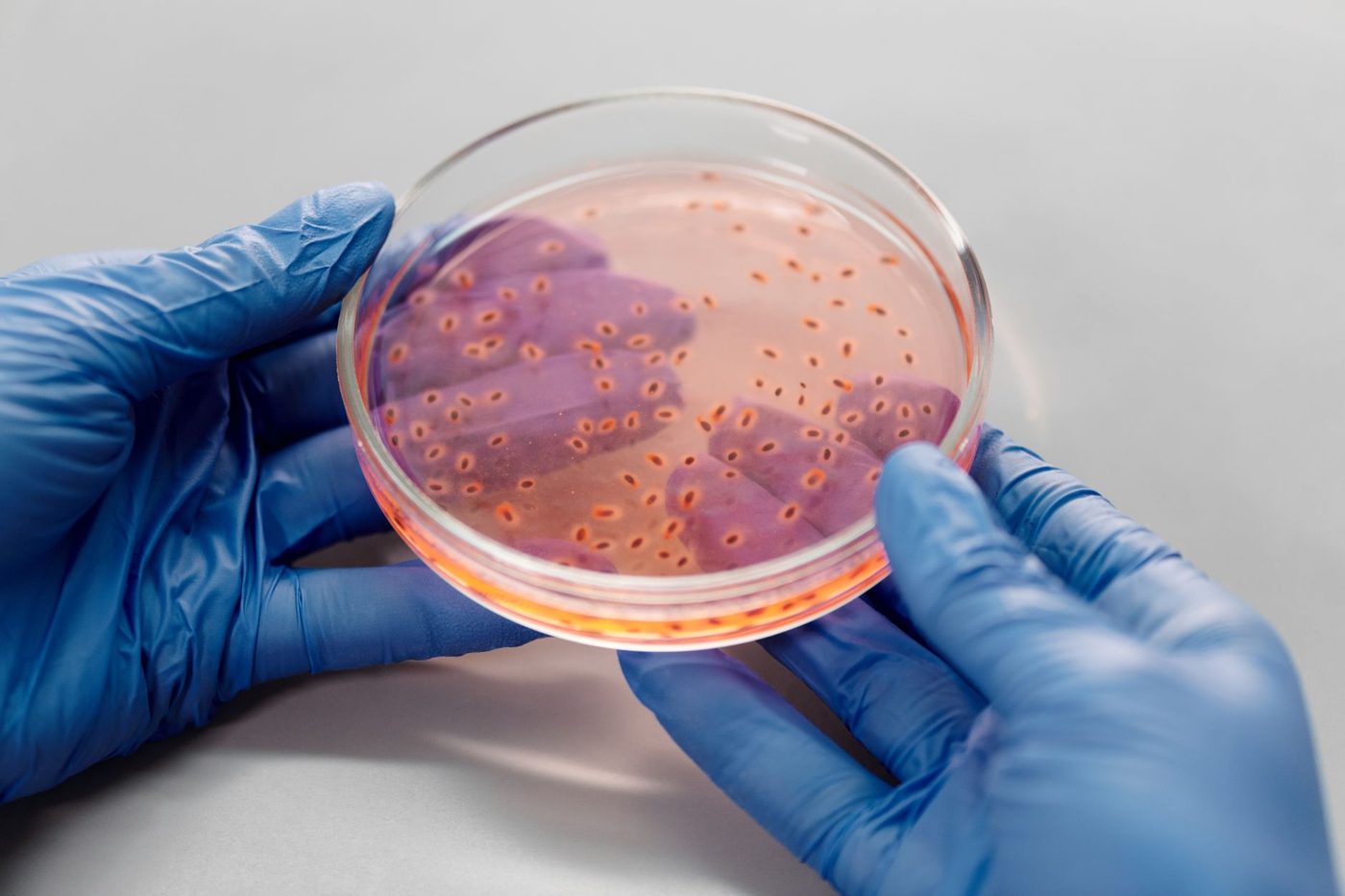 Reusachtige bacteriën mogelijk aanwezig in menselijke darmen